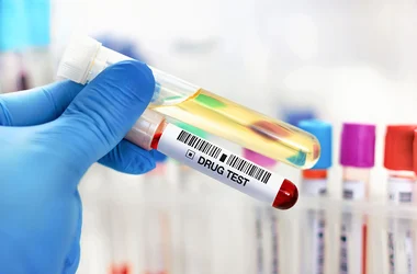 lab tech hand holding urine and blood tube test for analysis for doping or drugs. urinalysis and blood sample for drug test or alcohol in the laboratory