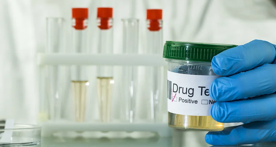 positive urine drug test