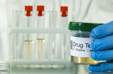 lab tech holding a positive drug test specimen cup