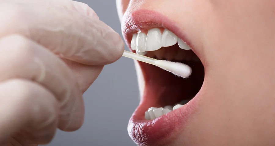 oral fluid sample