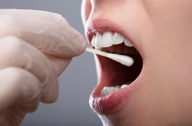 oral fluid sample
