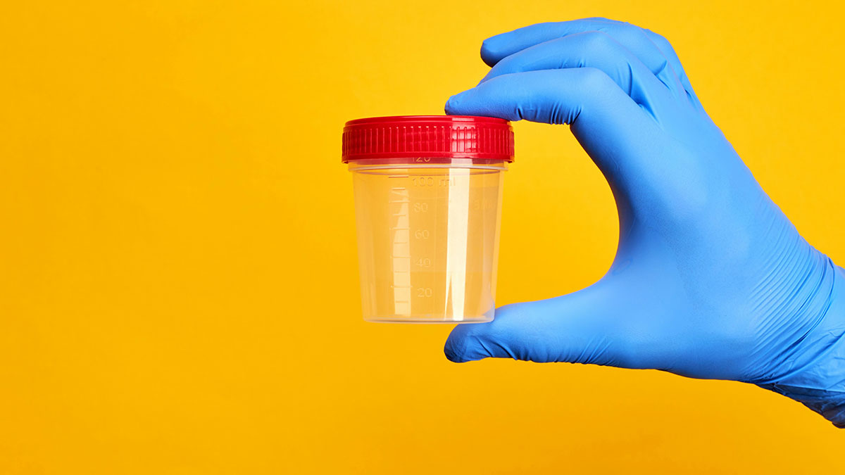 Gloved hands with thumbs up and a drug specimen container