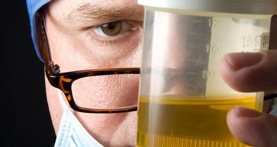 doctor examining a urine specimen closely
